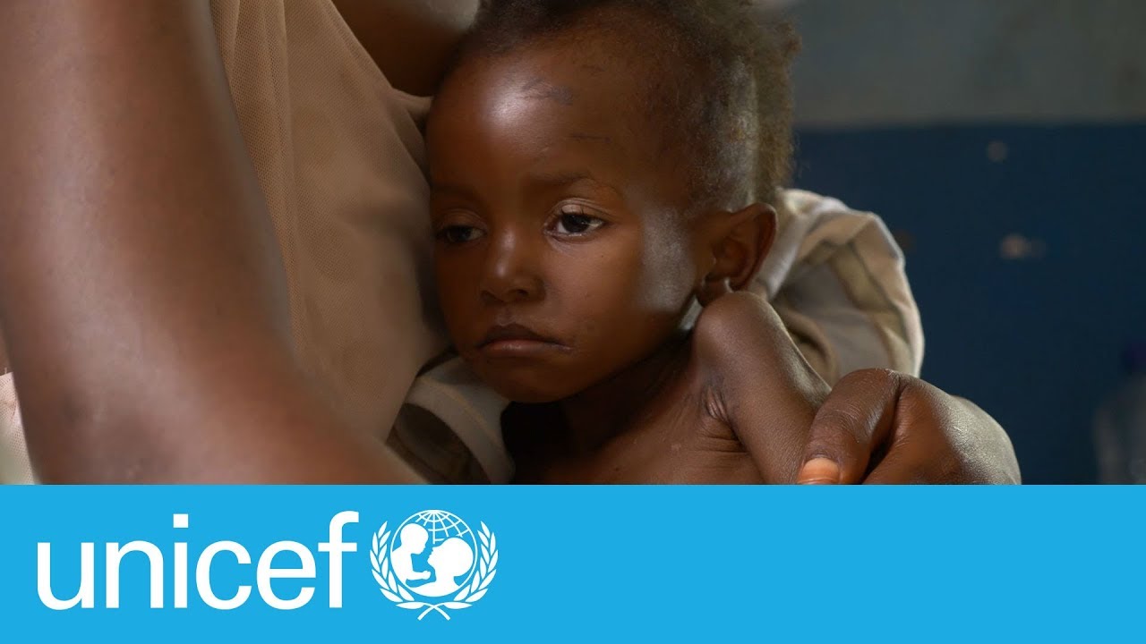 Você está visualizando atualmente UNICEF: Aumentam as crianças com desnutrição e com sobrepeso