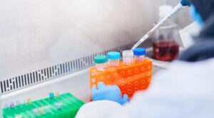 Read more about the article Aumenta número de testes positivos para Covid em laboratórios privados