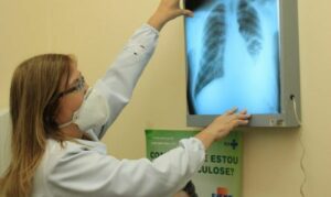 Leia mais sobre o artigo Dourados inaugura laboratório para o Diagnósticos de Tuberculose