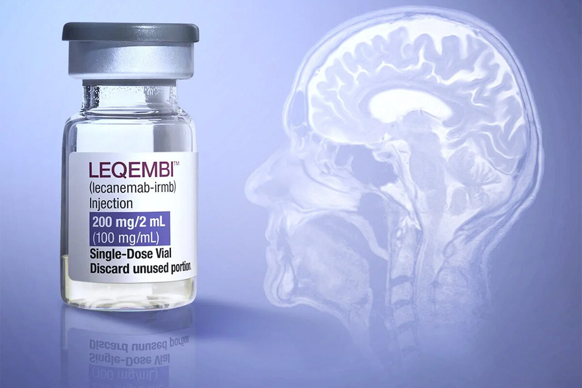 Você está visualizando atualmente ‘Anvisa’ dos EUA aprova medicação para Alzheimer