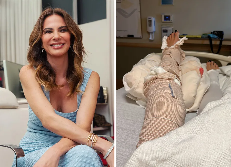 Você está visualizando atualmente Após cirurgia às pressas, Luciana Gimenez mostra perna quebrada