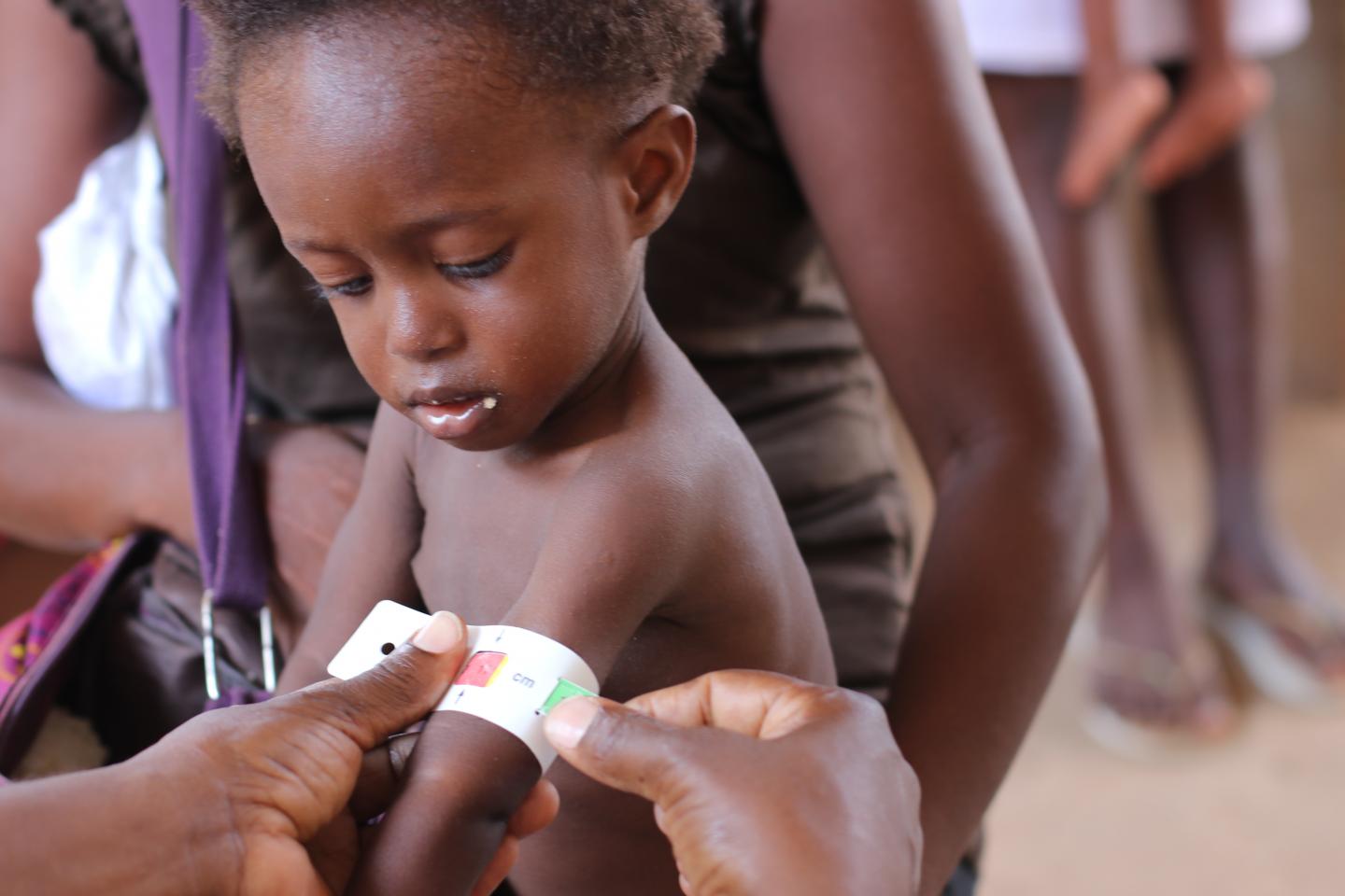 Você está visualizando atualmente ONU: Desnutrição aguda ameaça a vida de crianças vulneráveis
