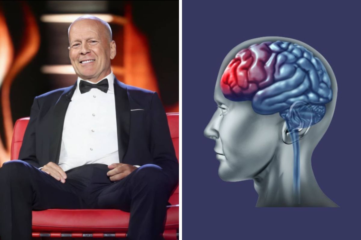 Você está visualizando atualmente Demência frontotemporal entenda a doença que afeta Bruce Willis