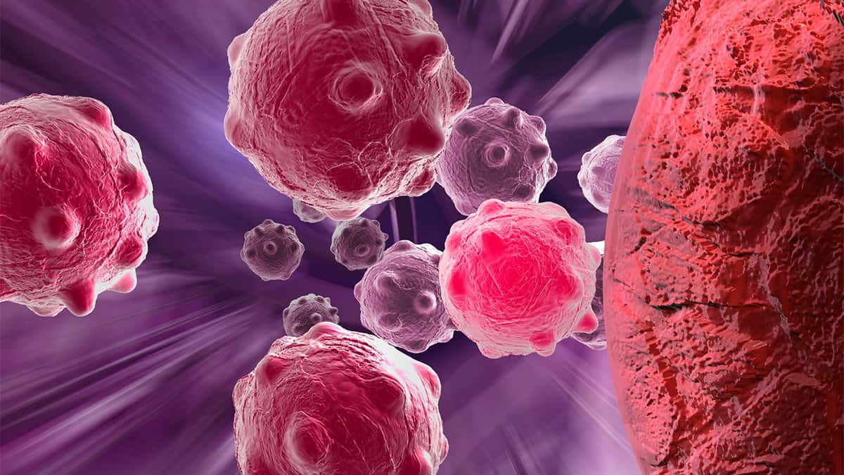 Você está visualizando atualmente Pesquisadores desenvolvem quimioterapia que ‘aniquila’ tumores