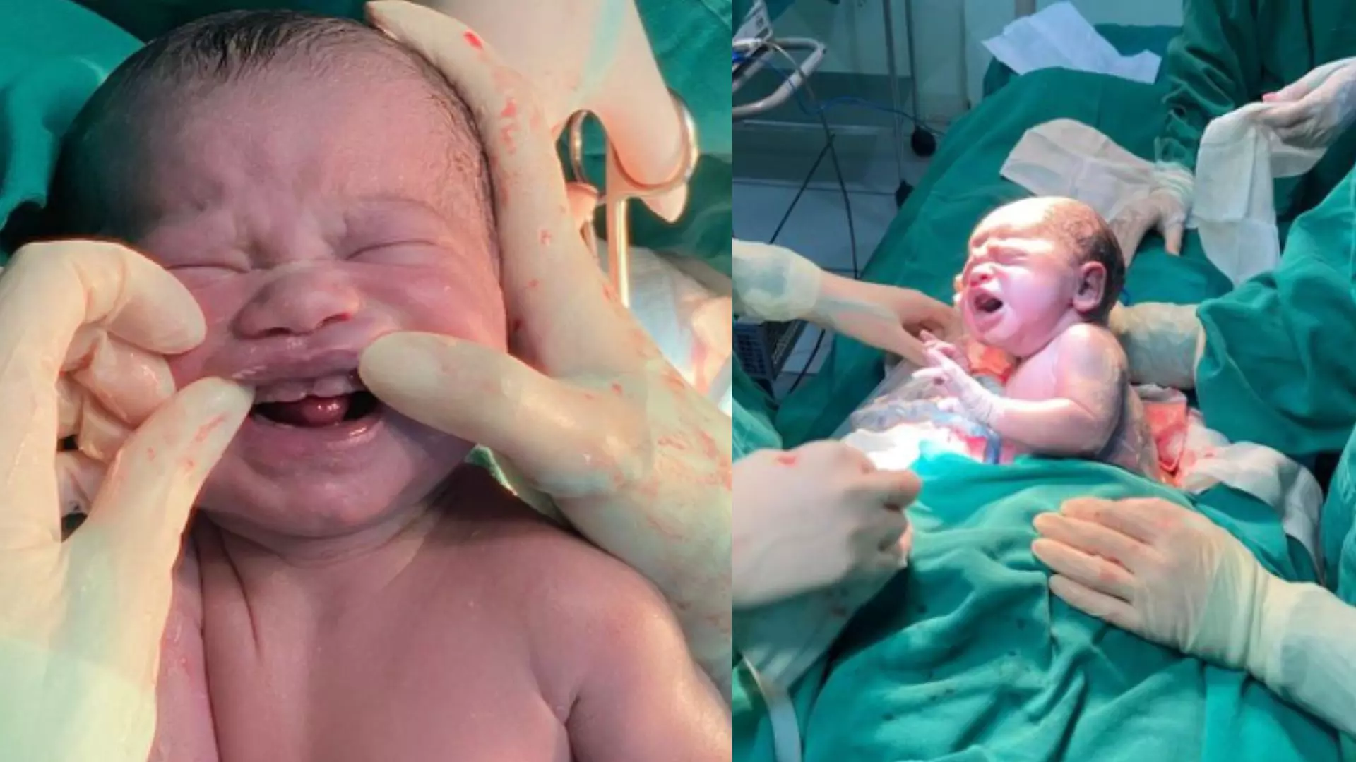 Você está visualizando atualmente ENTENDA: Bebê nasce com ‘6 dentes’ e surpreende médicos de Campo Grande