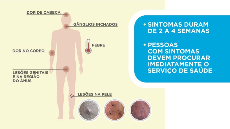 mpox-saiba-quais-sao-os-sintomas-e-formas-de-transmissao-1