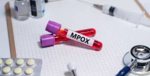 Leia mais sobre o artigo Brasil supera marca de mil casos de mpox em 2024