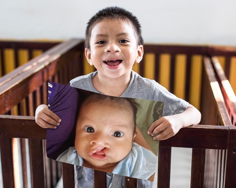 Você está visualizando atualmente Funcraf promove atividades gratuitas em alusão ao Dia Mundial do Sorriso