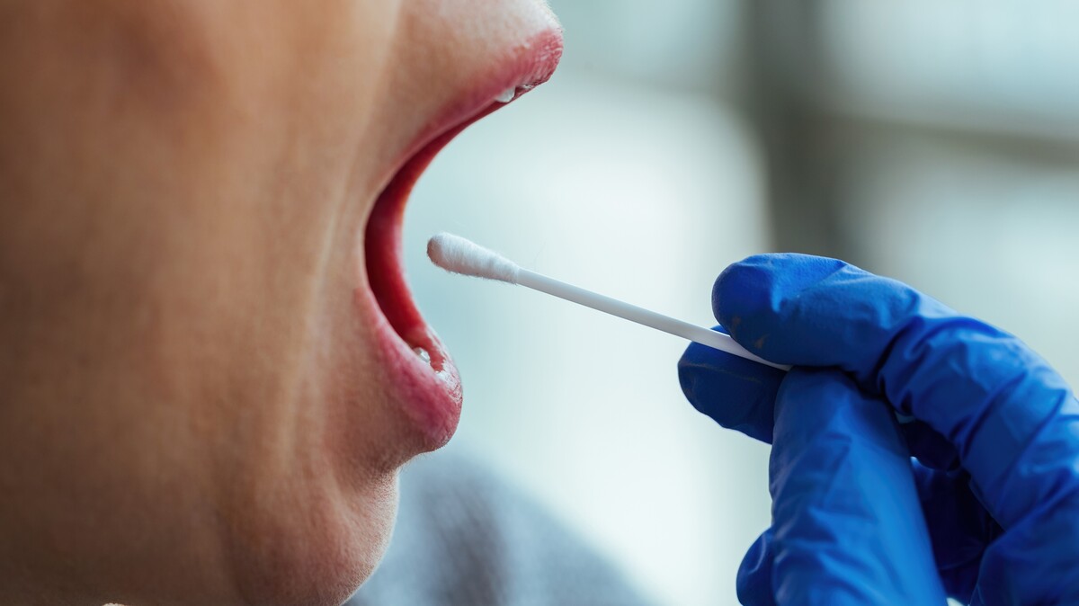 No momento, você está visualizando NOVEMBRO VERMELHO: Câncer de boca está entre os mais incidentes no Brasil