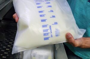 Leia mais sobre o artigo Hospital Regional inova e garante economia de R$ 1,6 milhão com projeto de Nutrição Parenteral Total