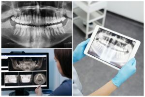 Leia mais sobre o artigo Prefeitura recebe novo RX panorâmico para a Odontologia Municipal de Naviraí