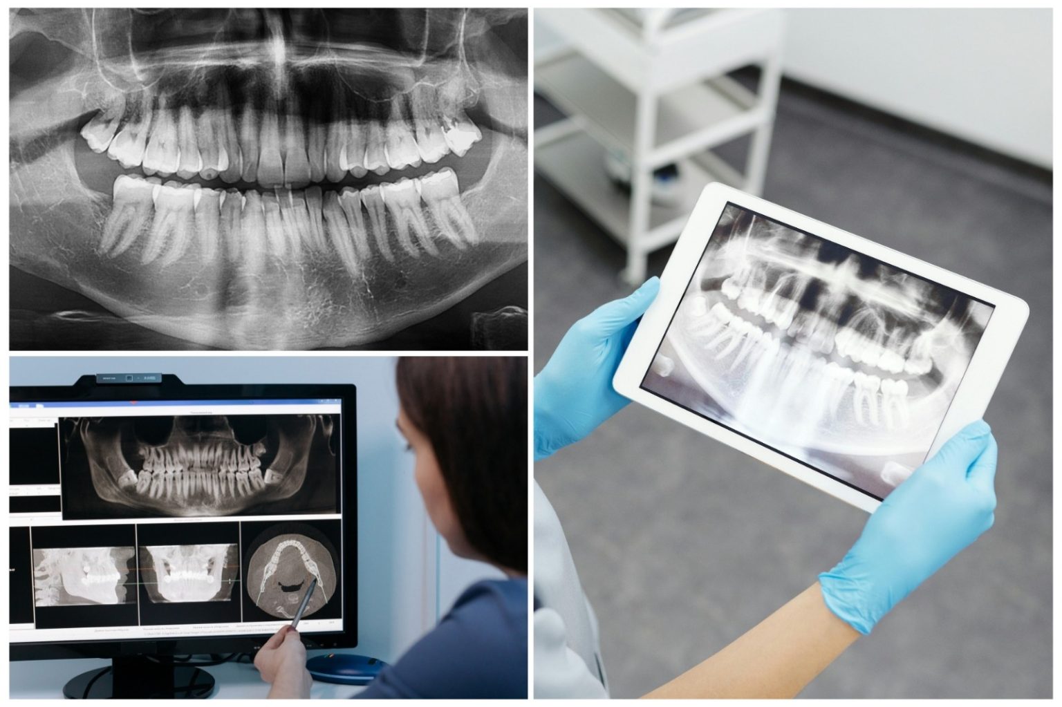No momento, você está visualizando Prefeitura recebe novo RX panorâmico para a Odontologia Municipal de Naviraí