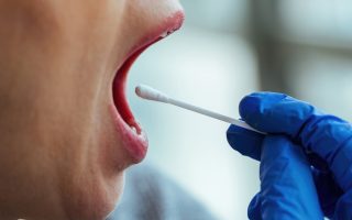 cancer-de-boca-esta-entre-os-mais-incidentes-no-brasil