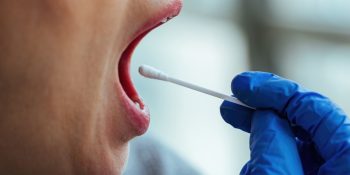 cancer-de-boca-esta-entre-os-mais-incidentes-no-brasil