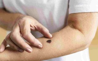 dezembro-laranja-chega-ms