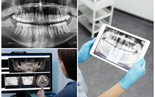 odontologia-municipal-navirai-recebe-equipamento