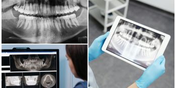 odontologia-municipal-navirai-recebe-equipamento