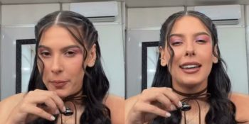 orelhas-de-abano-entenda-condicao-que-afeta-ana-castela